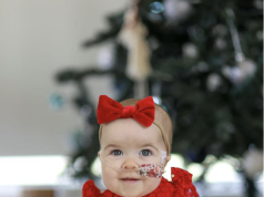 先天臍膨出昆州嬰兒 迎來人生首個聖誕