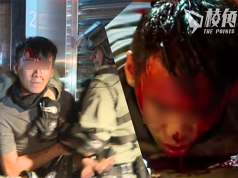 【圖片或引起不安】「岳義士」被警毆打頭破血流  反被警追討15萬賠償