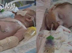 澳洲呼吸道合胞病毒(RSV)病例急升 傳染性極強 0至4歲幼童高危