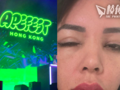 有片│傷者斥大會器材「淘返嚟」 參加港ApeFest視力受損 疑遭舞台紫外線灼傷眼睛